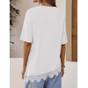 image:imageZESICA Womens Summer Oversized TShirts Asymmetrical Lace Going Out Tops  Asymmetrical Lace Trim Short Sleeve Baggy Loose Fit Tunic Dressy Casual Blouse Work Going Out Gym OutfitsWhite