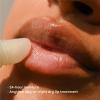 imageeos 24H Moisture Super Balm Minis Melon Magic LimitedEdition Lip Mask Variety Pack 0169 fl oz 3PackCoconut Milk
